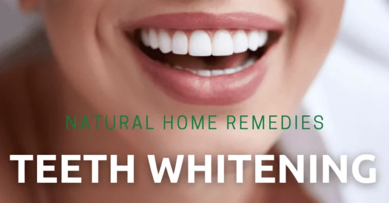Teeth Whitening: Natural Home Remedies