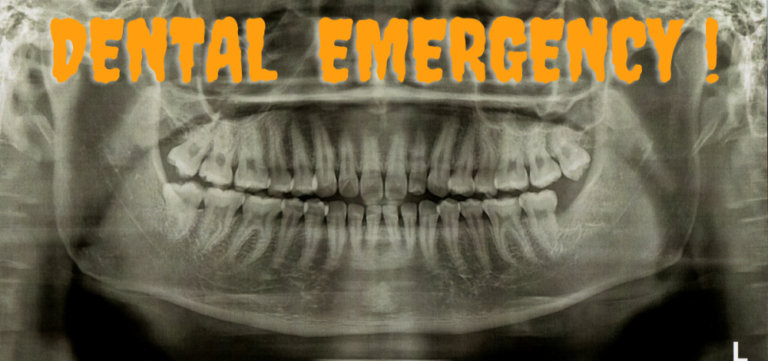 Know What a Dental Emergency Looks Like & When to Call a Dentist