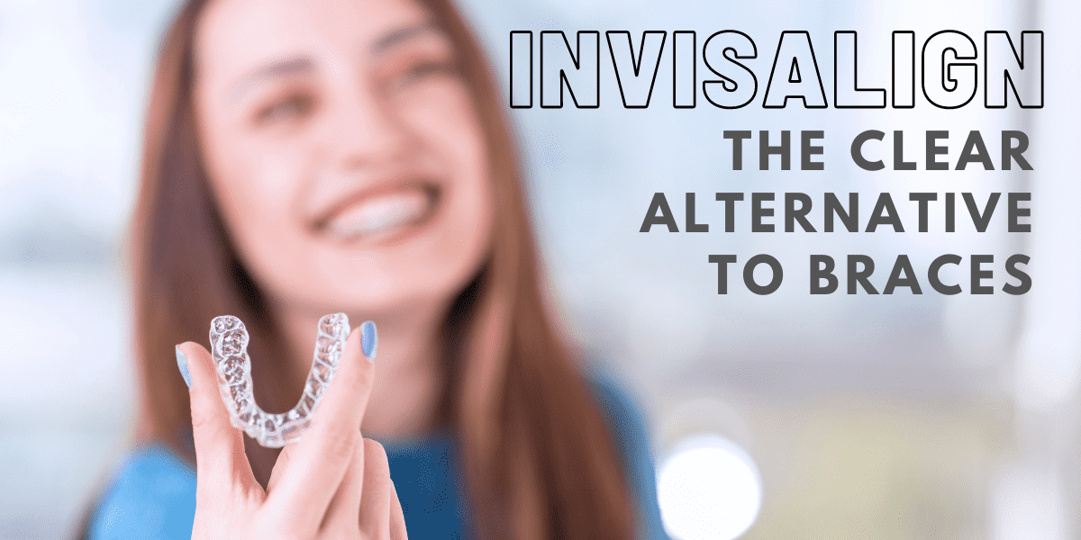 Invisalign Aligners Treatment, costs, and why you should get them
