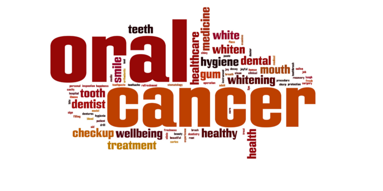Oral Cancer Preventing Tips: Natural Oral Cancer Treatment