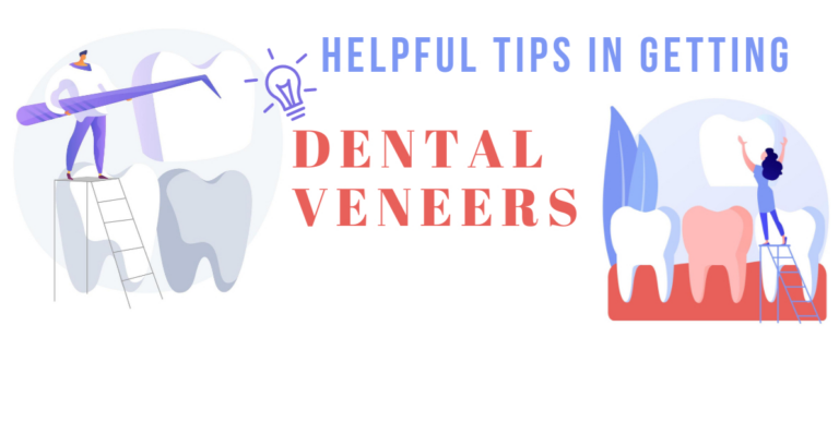 Thinking of Getting Dental Veneers: Is it right for you?