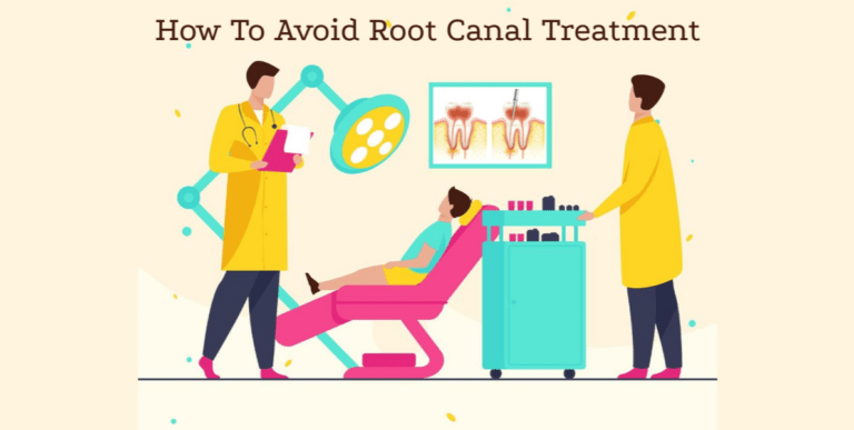 Access to Dental Advice: How to Avoid Needing a Root Canal