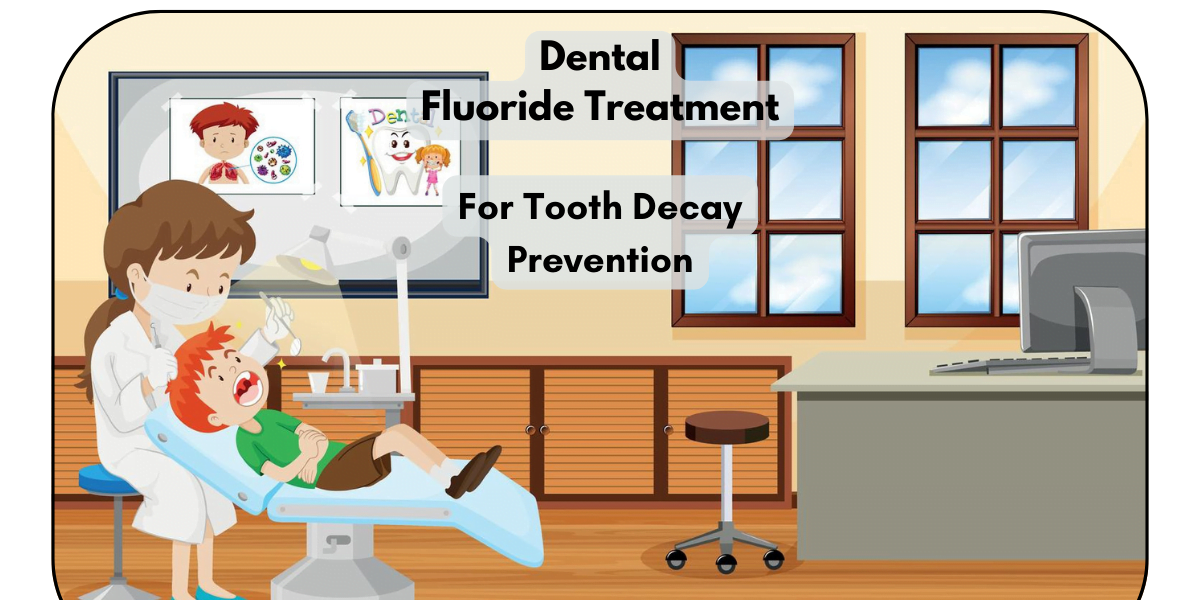 Dental Fluoride Treatment: The Best Way To Prevent Tooth Decay