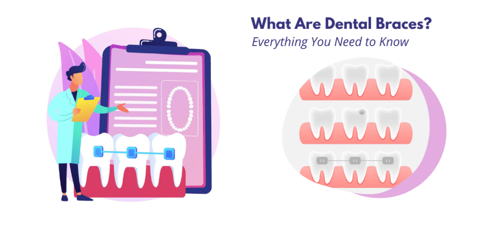 A Comprehensive List of Dental Procedures and Techniques What you need to