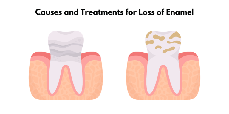 Poor Teeth Enamel: Unveil Causes and Treatments for Loss of Enamel or Enamel Hypoplasia