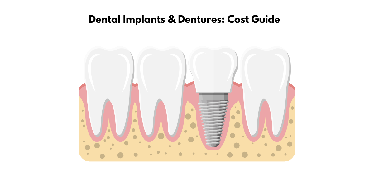 affordable dental implants
